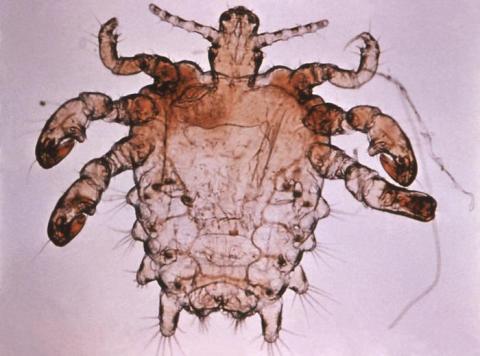 A picture of the STI crabs.